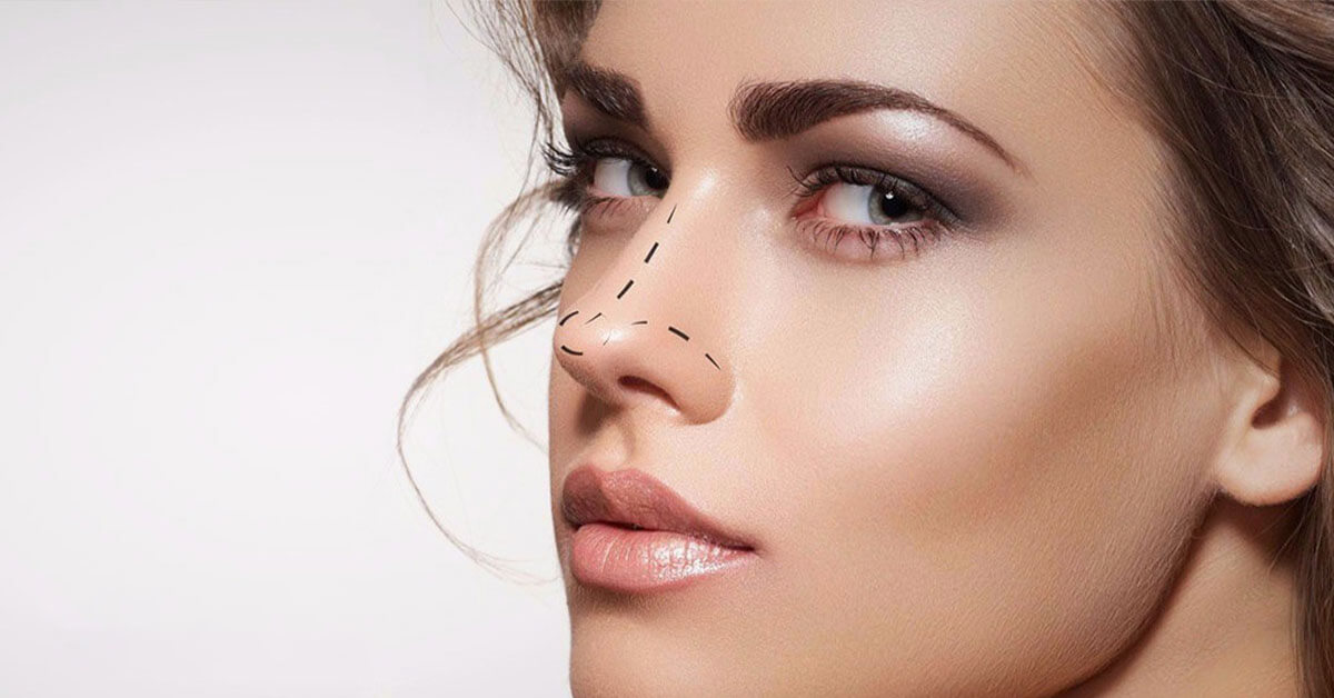rinoplastika-samochuvstvie-unimedturkey-1.jpg
